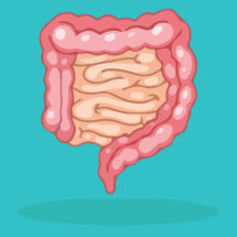 chronic intestinal pseudo-obstruction is condition with digestive tract paralysis that affects the small intestine and the colon or large intestine