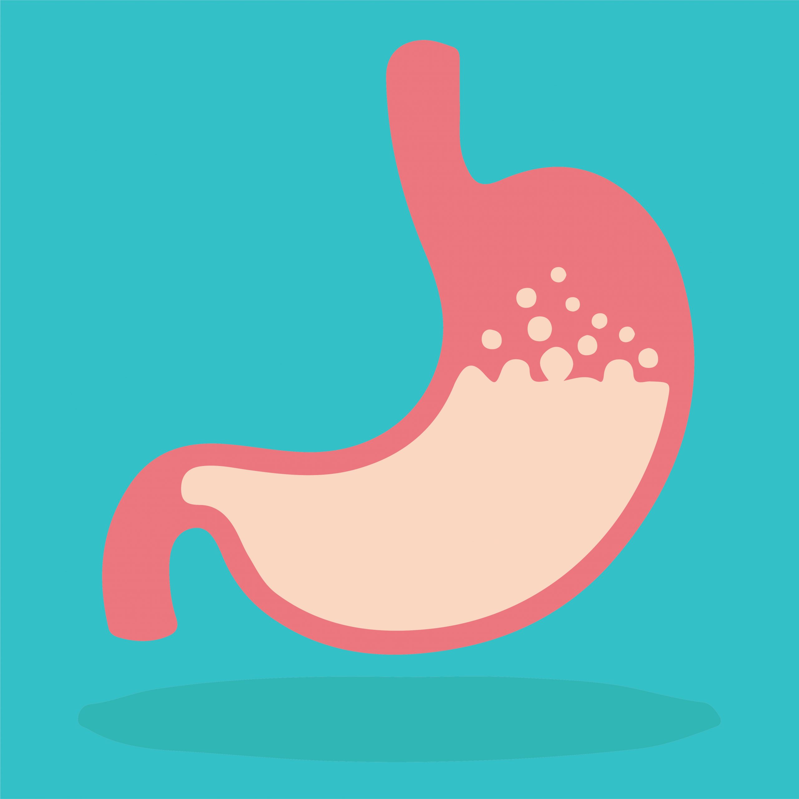Gastroparesis is condition with digestive tract paralysis that affects the stomach